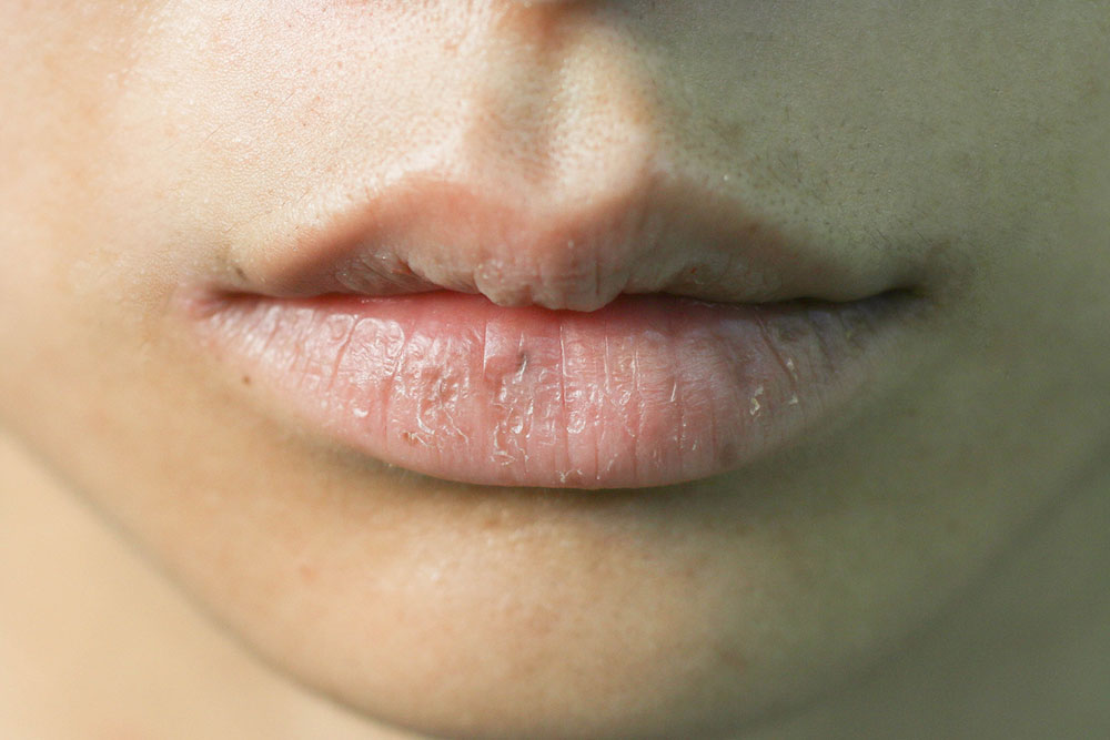 4 common mistakes that make one&#8217;s lips dry and damaged