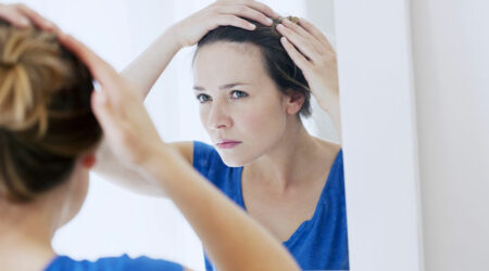 Medical conditions that can trigger severe hair loss