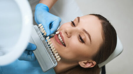 Things to know before opting for dental veneers