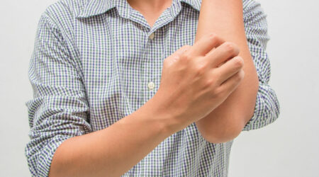 10 warning signs of eczema to watch out for