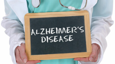 5 things to know about Alzheimer&#8217;s disease