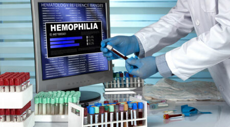 5 ways to live healthy with hemophilia