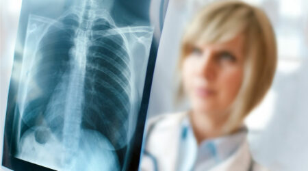 5 mistakes that can affect lung health