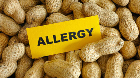 5 most common food allergies