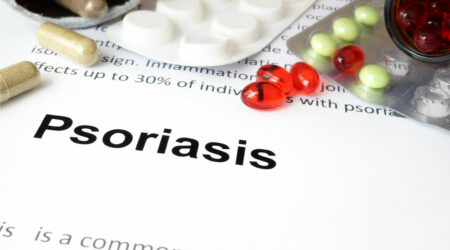 6 common health conditions related to psoriasis