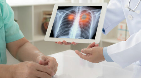 6 signs that indicate a lung disease