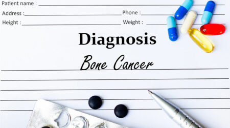 9 warning signs that indicate bone cancer